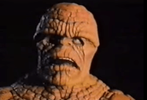 I give you: Donald Trump without his wig.